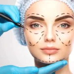 افضل دكتور تجميل في الرياض