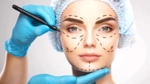 افضل دكتور تجميل في الرياض